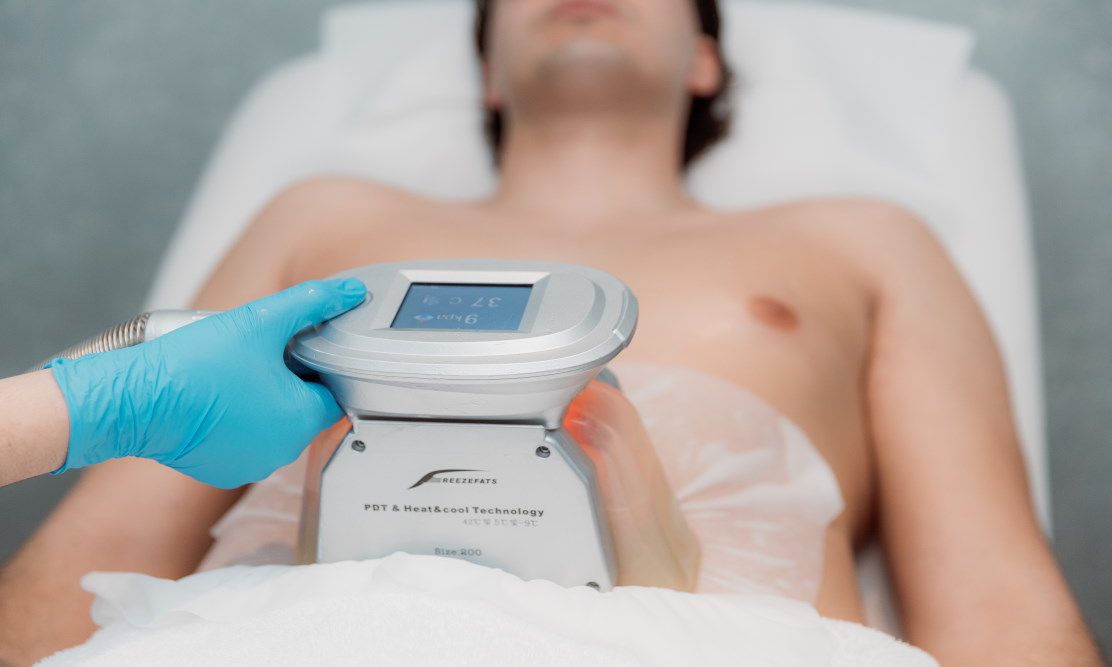 Are you the ideal candidate for Cryolipolysis ?